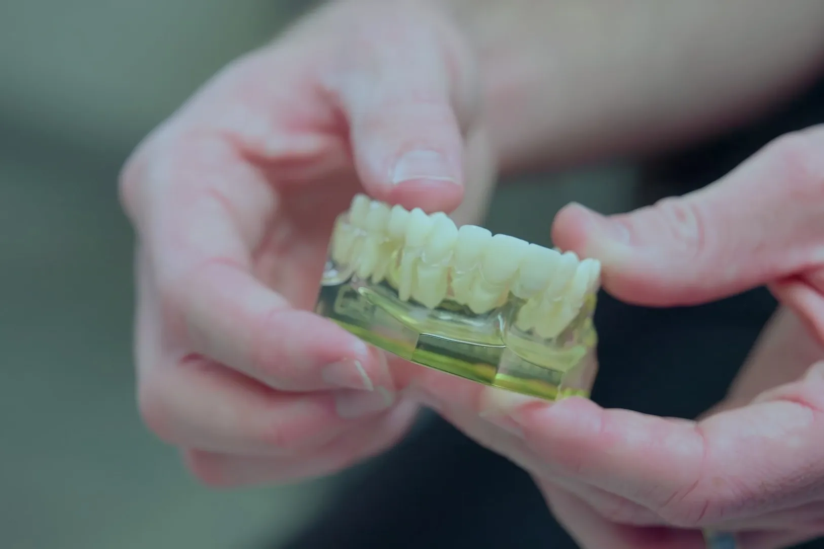 A clear model of the teeth held in a dentist's hands while explaining Invisalign clear aligner treatment at Cardinal Point Dental in Jacksonville, FL