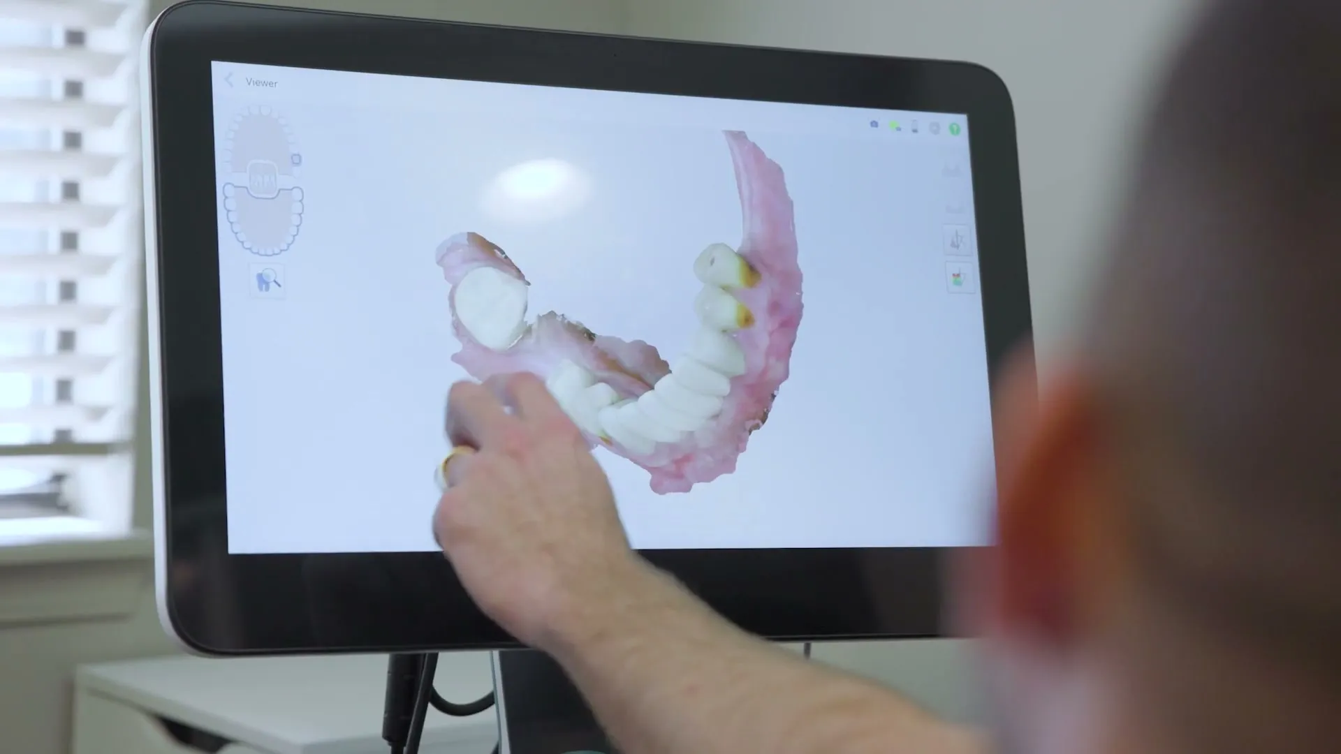 A dentist's hand pointing at a 3D scan of teeth on a chairside monitor at Cardinal Point Dental — Invisalign clear aligners in Jacksonville, FL