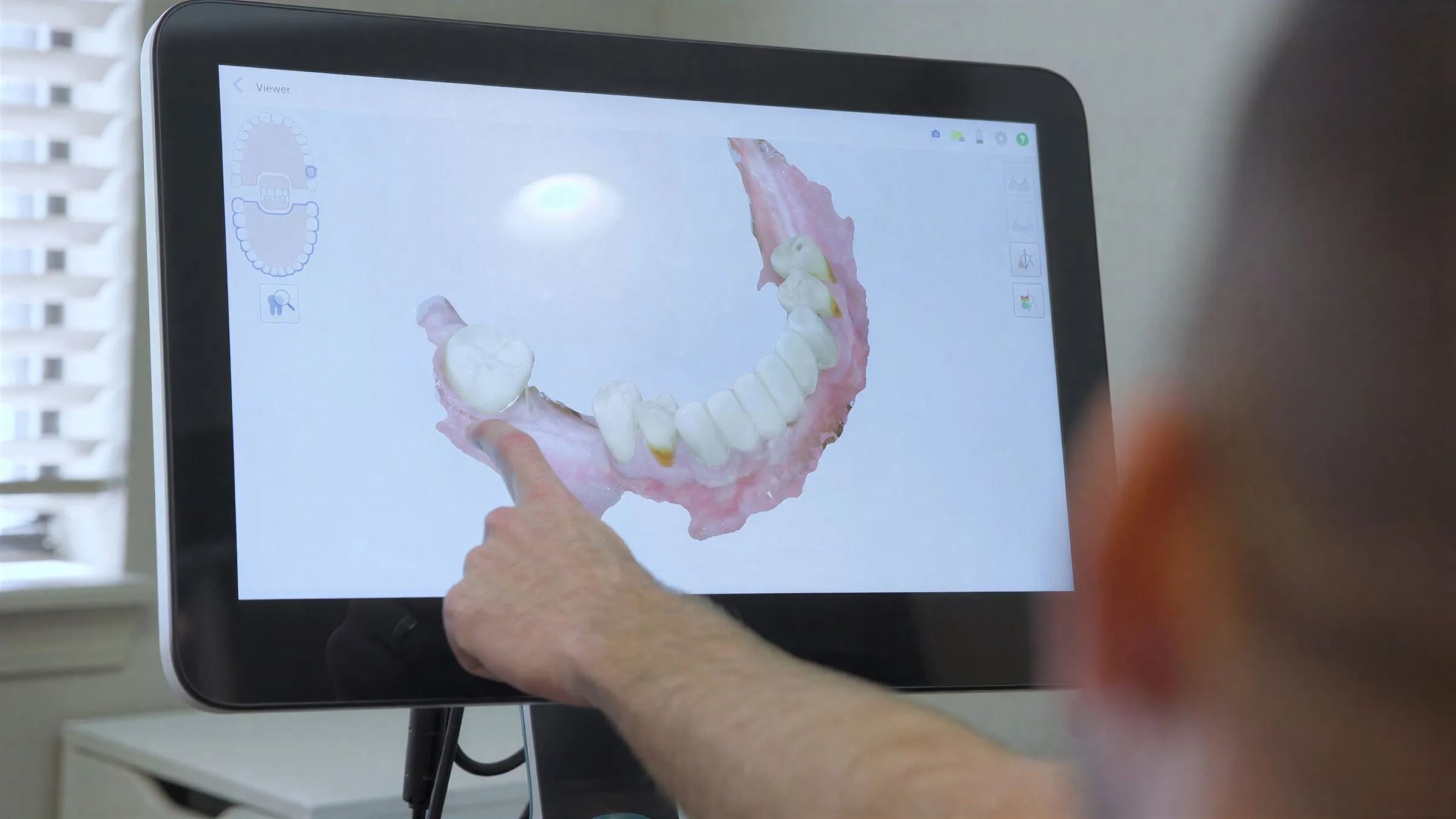 A finger pointing at a 3D digital scan of teeth on a monitor at Cardinal Point Dental, Jacksonville, FL (teeth cleanings and exams)