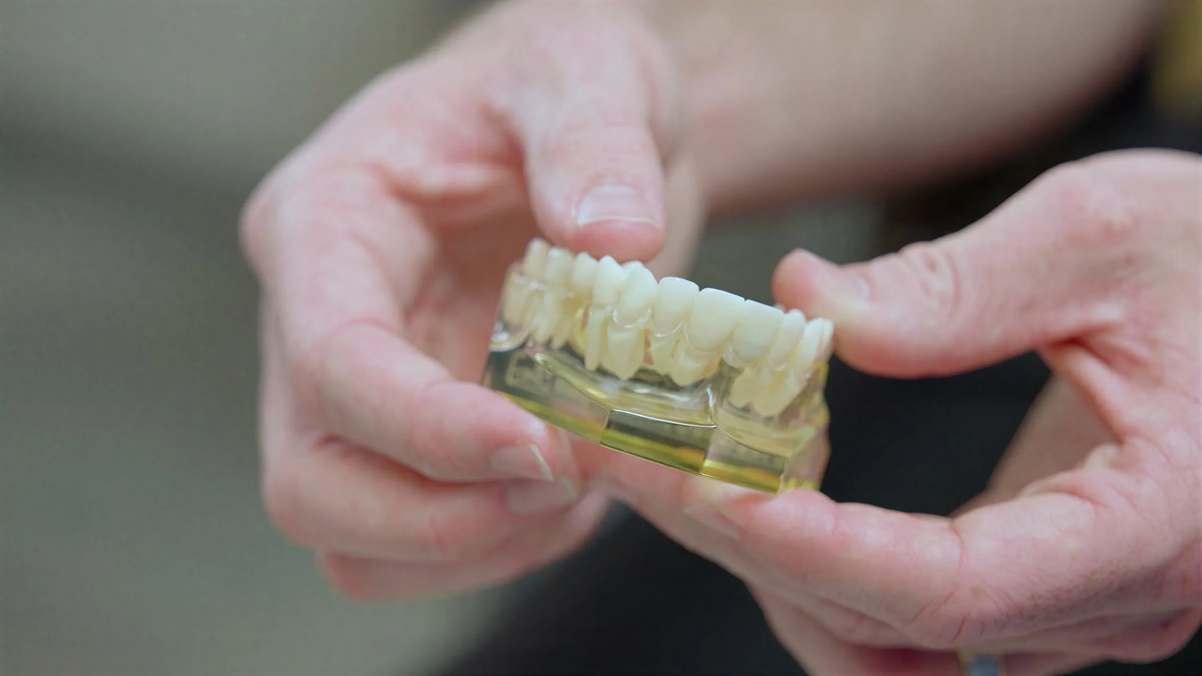 Hands holding a dental bridge model at Cardinal Point Dental, at a Jacksonville, FL dental office offering dental crowns